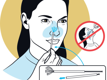 swab diagram