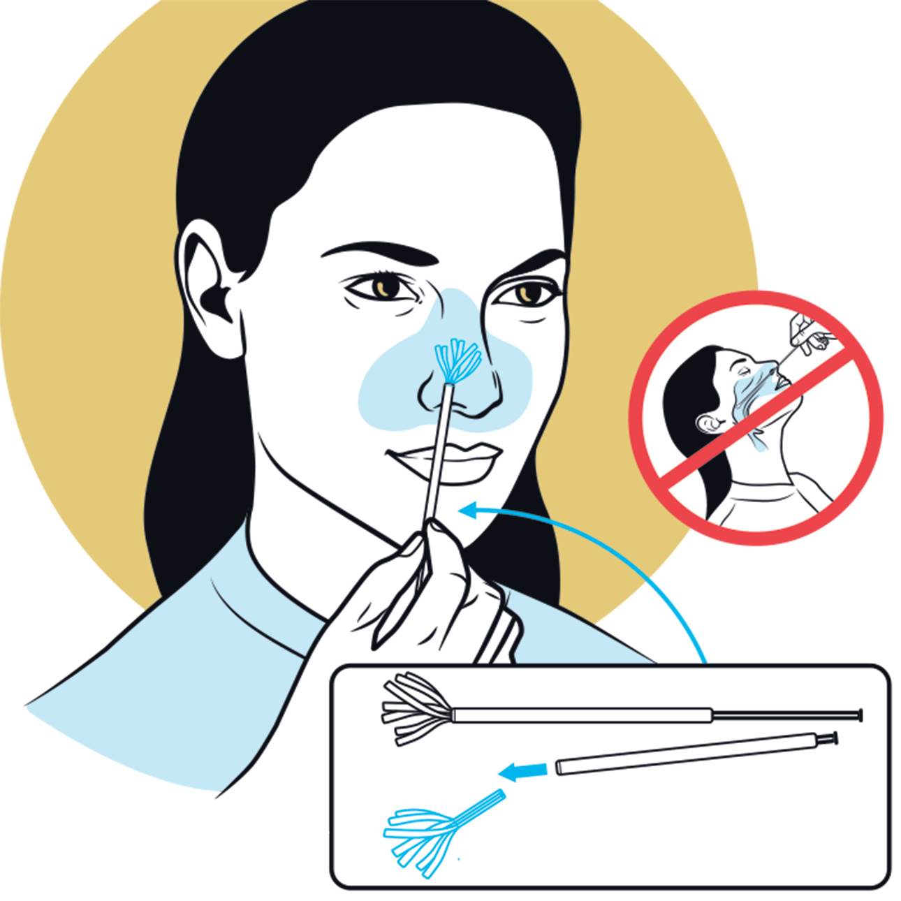 What is a Nasopharyngeal Swab?