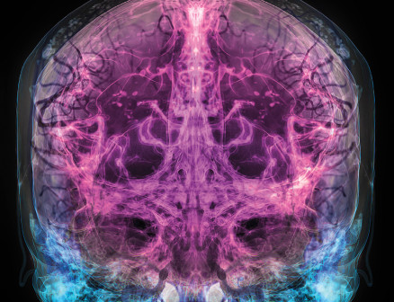 An image of a brain.