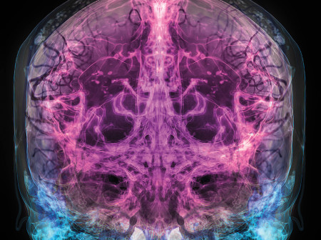 An image of a brain.