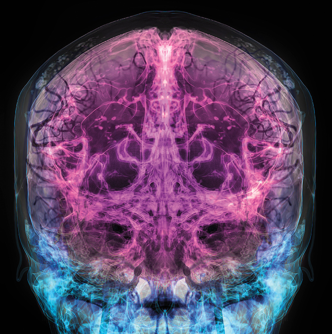 An image of a brain.